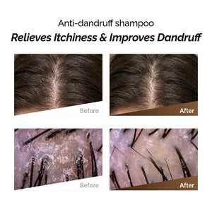 Rootonix Anti Dandruff Sjampó 500ml