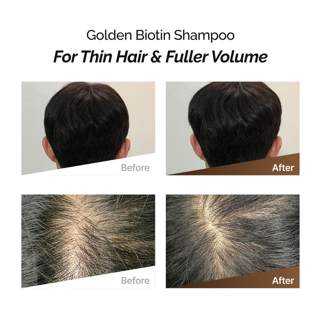 Rootonix Golden Biotin Sjampó 500ml