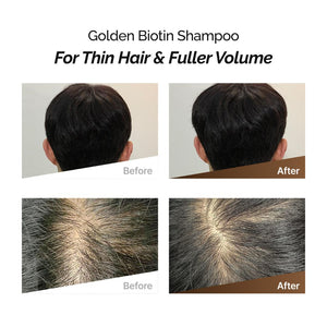 Rootonix Golden Biotin Sjampó 500ml